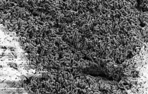 2) Electron microscope image of the microbe, Geobacter sulfurreducens, the core of the microbial fuel cell-based system