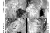 Coronal images from June 10 to June 17, 2011, showing that the cells change to elongated plumes when seen in perspective.