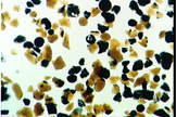 A photomicrograph of sphere and fragments in "orange" soil from Apollo 17.