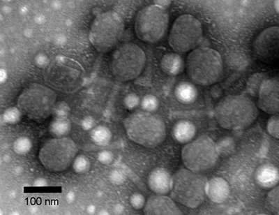 The dark round blobs in this photomicrograph are the capsids of Bacteriophage T4 virus particles, which retain their characteristic shape after being coated with silica. The long, straight "tails" of many of the virus particles can be seen extending from the capsids in this image as well.