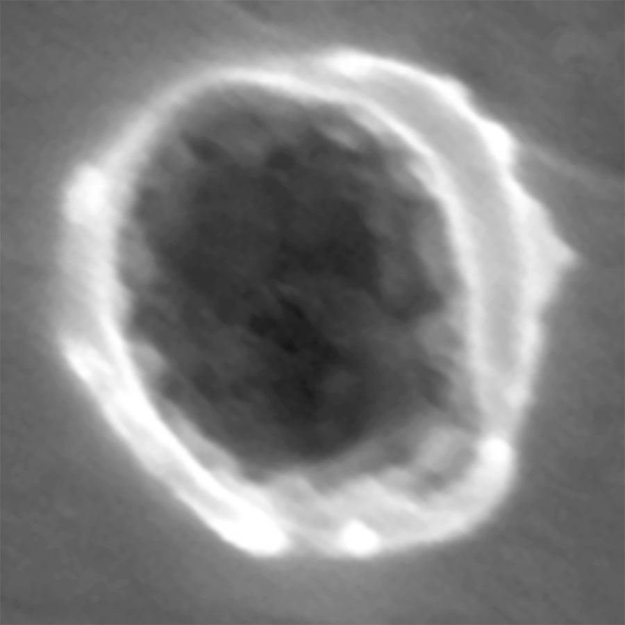Dust Particle Impact on Stardust's A1 Foil Collector